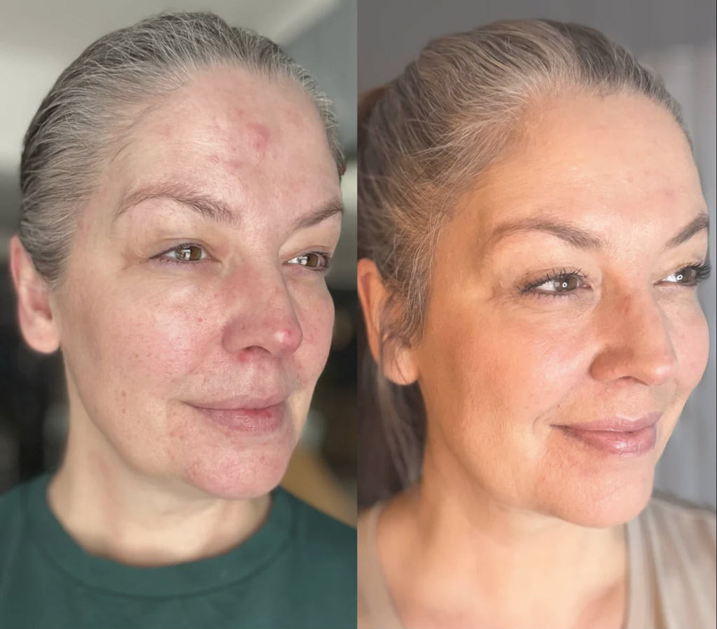 NovaLume 7-Color LED Red Light Mask for Smoother Skin