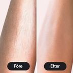 Sistema di rimozione dei peli IPL LumaNova per uso domestico per una pelle liscia