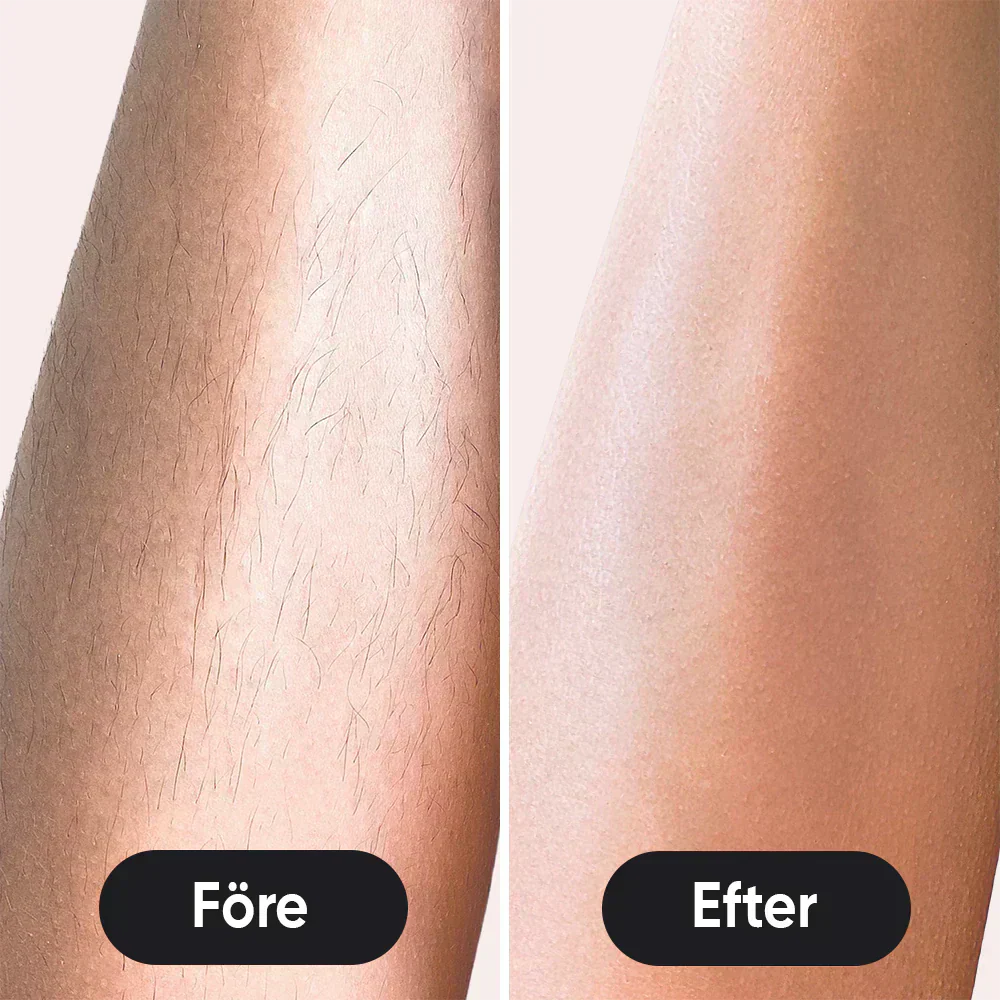 Sistema di rimozione dei peli IPL LumaNova per uso domestico per una pelle liscia