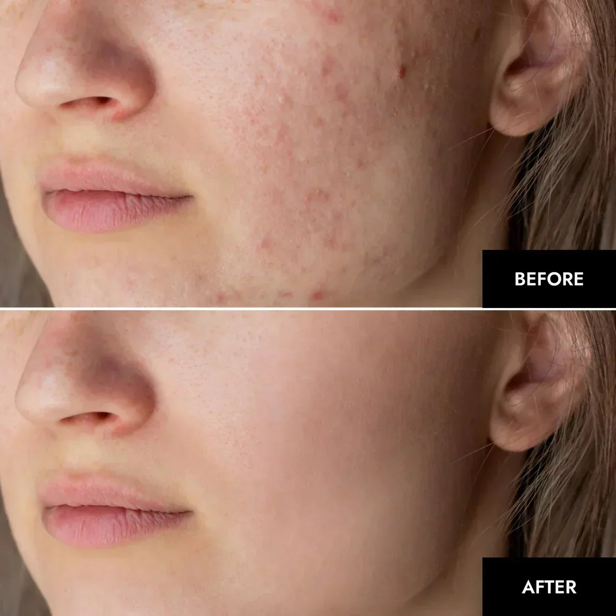 מסכת קולגן מנאופייבר ללחות והפחתת קמטים