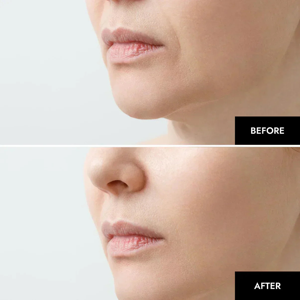 מסכת קולגן מנאופייבר ללחות והפחתת קמטים