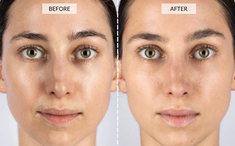 NovaLume 7-Color LED Red Light Mask for Smoother Skin