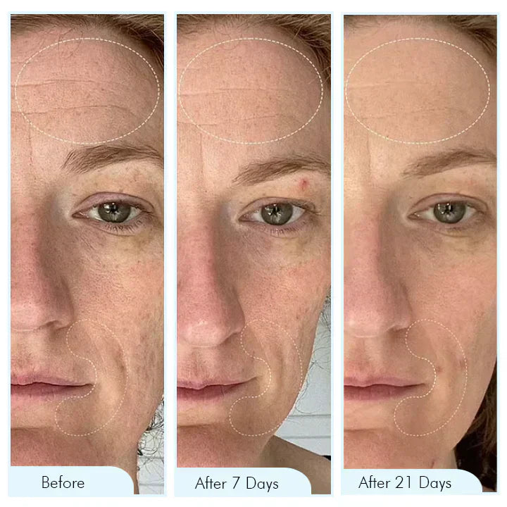 Maschera Bio-Collagene LuminaBio per Idratazione Profonda e Luminosità