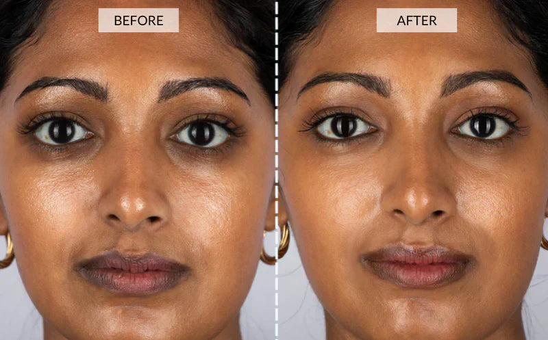 NovaLume 7-Color LED Red Light Mask for Smoother Skin