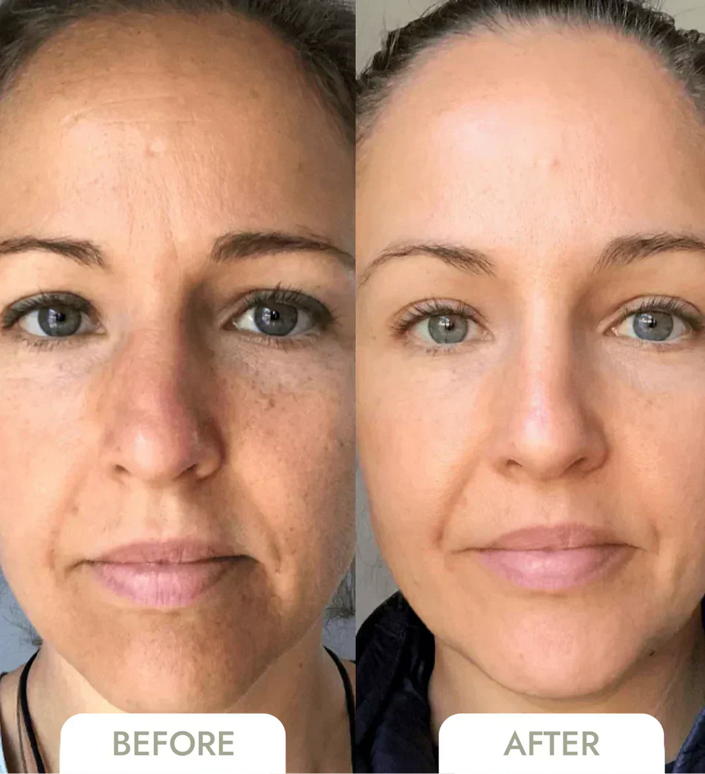 מסכת קולגן מנאופייבר ללחות והפחתת קמטים