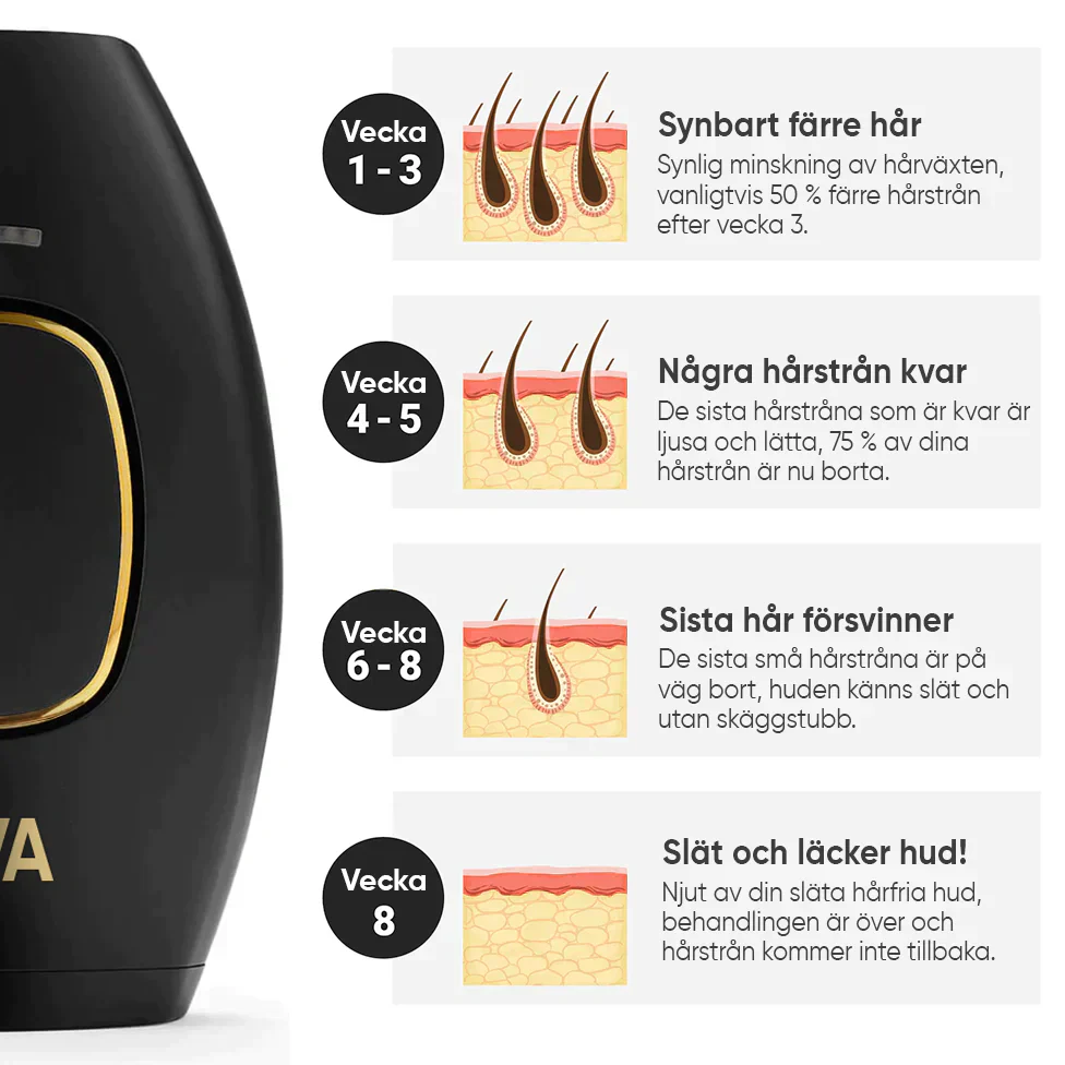 Sistema di rimozione dei peli IPL LumaNova per uso domestico per una pelle liscia